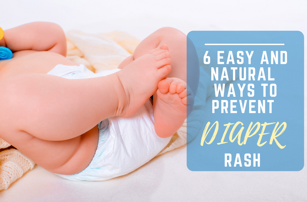 6 Easy and Natural Ways To Prevent Diaper Rash